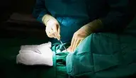 surgery-3034070_1280.webp