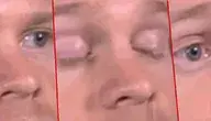 Drew Scanlon, znany jako „mrugający biały koleś” z popularnego mema, wykorzystuje swoją sławę, by wspierać badania nad stwardnieniem rozsianym.