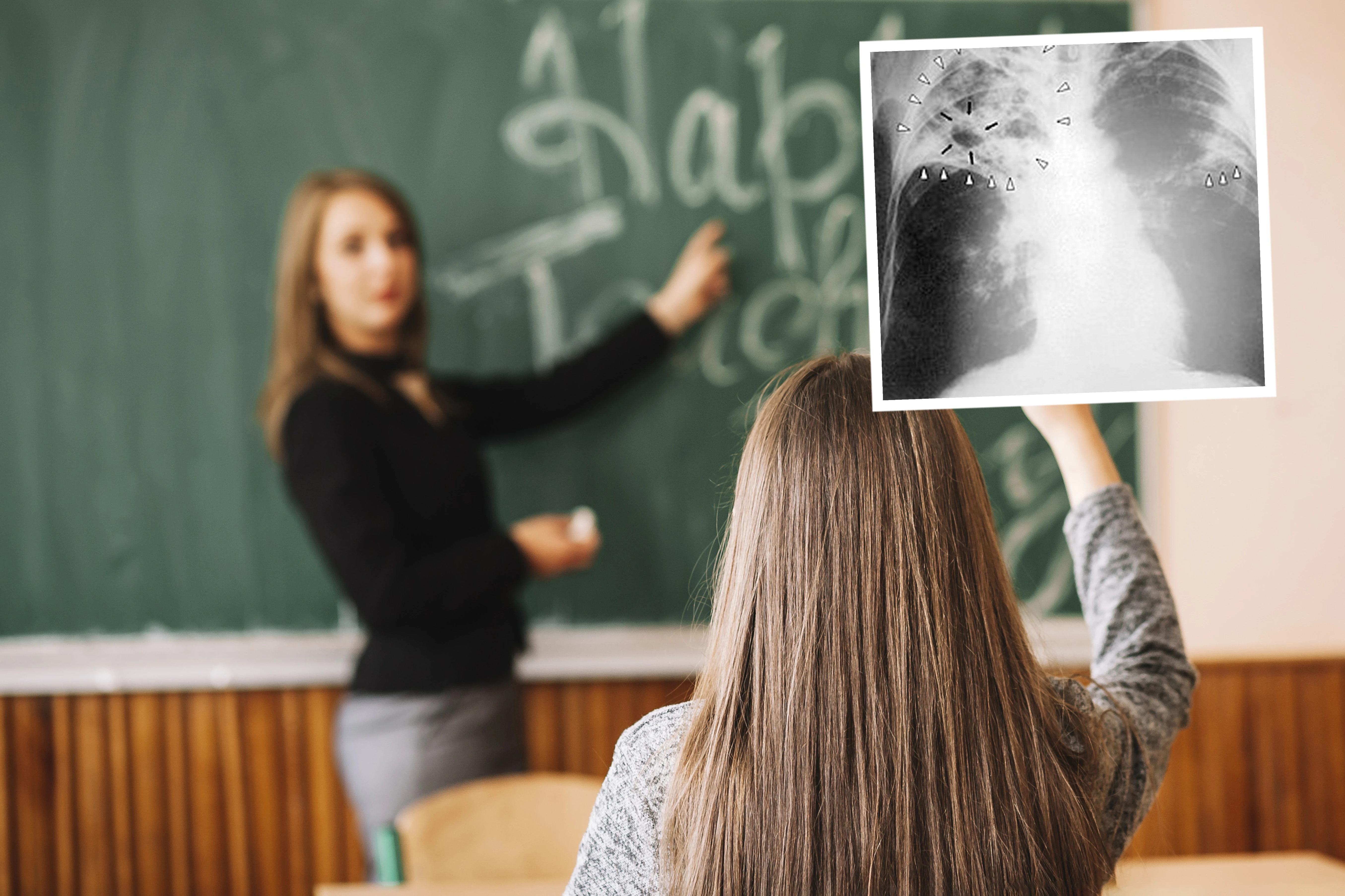 Ważny alarm dla dużego miasta! Nauczycielka z gruźlicą. Setki osób do diagnozy