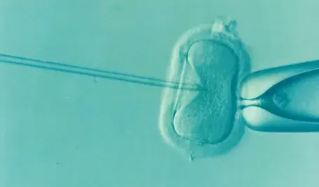 ivf-1514174_1280 (1).webp