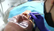 dentist-7397735_1280.webp