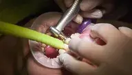 dentist-1864918_1280.webp