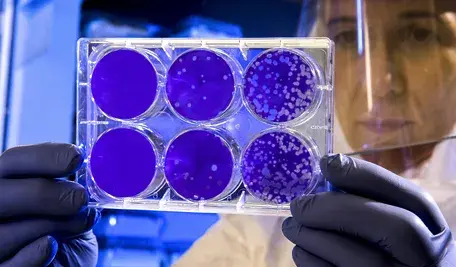 covid-19-coronavirus-covid-cell-pandemic-corona-virus-1608795-pxhere.com.webp