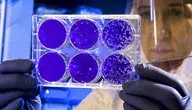 covid-19-coronavirus-covid-cell-pandemic-corona-virus-1608795-pxhere.com.webp