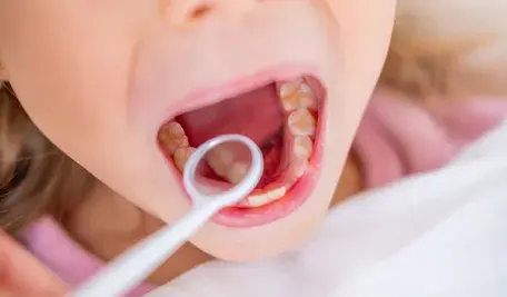 Dziewczynka u dentysty