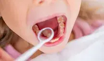 Dziewczynka u dentysty 