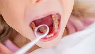 Dziewczynka u dentysty