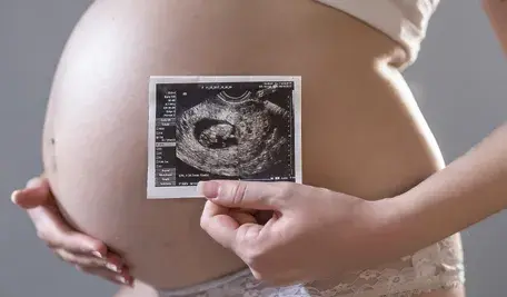 Ochrona życia nienarodzonego dziecka – kobieta w ciąży trzyma USG przy brzuchu, pro‑life motyw