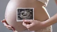 Ochrona życia nienarodzonego dziecka – kobieta w ciąży trzyma USG przy brzuchu, pro‑life motyw