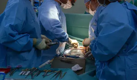 Lekarze podczas zabiegu operacyjnego na sali operacyjnej w szpitalu, w tle narzędzia chirurgiczne i zespół medyczny przy stole operacyjnym.