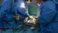 Lekarze podczas zabiegu operacyjnego na sali operacyjnej w szpitalu, w tle narzędzia chirurgiczne i zespół medyczny przy stole operacyjnym.