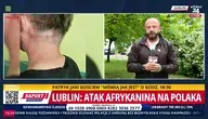 Afrykańczyk, który zaatakował Polaka już na wolności 