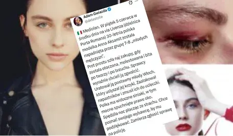 Polska modelka została brutalnie zaatakowana w centrum Mediolanu, a atak przerwała interwencja przypadkowego przechodnia.