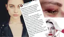 Polska modelka została brutalnie zaatakowana w centrum Mediolanu, a atak przerwała interwencja przypadkowego przechodnia.