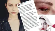 Polska modelka została brutalnie zaatakowana w centrum Mediolanu, a atak przerwała interwencja przypadkowego przechodnia.