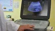 Pacjentka w ciąży, u której stwierdzono pęknięcie macicy i krwotok wewnętrzny, czekała trzy godziny na pomoc ginekologa w Szpitalu Południowym